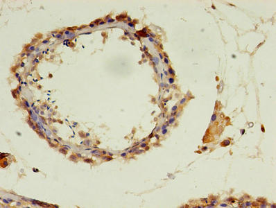Immunohistochemistry of paraffin-embedded human testis tissue using CSB-PA018343LA01HU at dilution of 1:100