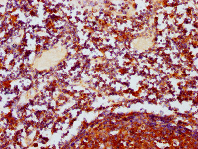 IHC image of CSB-PA018353LA01HU diluted at 1:400 and staining in paraffin-embedded human lymph node tissue performed on a Leica BondTM system. After dewaxing and hydration, antigen retrieval was mediated by high pressure in a citrate buffer (pH 6....