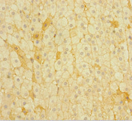 Immunohistochemistry of paraffin-embedded human adrenal gland tissue using CSB-PA018363NJ01HU at dilution of 1:100