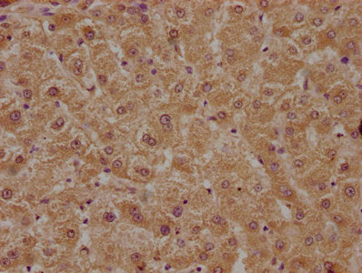 IHC image of CSB-PA018369LA01HU diluted at 1:400 and staining in paraffin-embedded human liver tissue performed on a Leica BondTM system. After dewaxing and hydration, antigen retrieval was mediated by high pressure in a citrate buffer (pH 6.0). S...