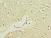 Immunohistochemistry of paraffin-embedded human brain tissue using CSB-PA018373ESR1HU at dilution of 1:100