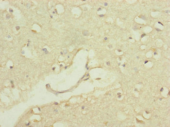 Immunohistochemistry of paraffin-embedded human brain tissue using CSB-PA018373ESR1HU at dilution of 1:100