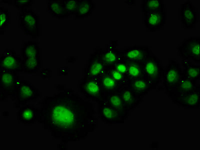 Immunofluorescence staining of Hela cells with CSB-PA018393LA01HU at 1:166, counter-stained with DAPI. The cells were fixed in 4% formaldehyde, permeabilized using 0.2% Triton X-100 and blocked in 10% normal Goat Serum. The cells were then incubat...