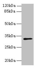 Western blot All lanes: PLPP2 antibody at 8µg/ml + MCF-7 whole cell lysate Secondary Goat polyclonal to rabbit IgG at 1/10000 dilution Predicted band size: 33, 35, 27 kDa Observed band size: 33 kDa