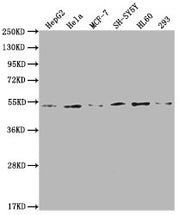 Western Blot Positive WB detected in: HepG2 whole cell lysate, Hela whole cell lysate, MCF-7 whole cell lysate, SH-SY5Y whole cell lysate, HL60 whole cell lysate, 293 whole cell lysate All lanes: PPARA antibody at 1:2000 Secondary Goat polyclonal...
