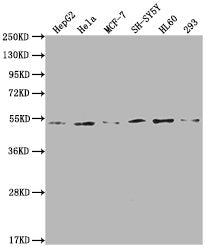 Western Blot Positive WB detected in: HepG2 whole cell lysate, Hela whole cell lysate, MCF-7 whole cell lysate, SH-SY5Y whole cell lysate, HL60 whole cell lysate, 293 whole cell lysate All lanes: PPARA antibody at 1:2000 Secondary Goat polyclonal...