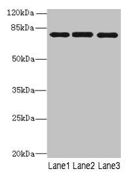 Western blot All lanes: PPEF1 antibody at 1µg/ml Lane 1: U251 whole cell lysate Lane 2: A549 whole cell lysate Lane 3: Mouse gonadal tissue Secondary Goat polyclonal to rabbit IgG at 1/10000 dilution Predicted band size: 76, 70, 73, 45, 69 kDa Obs...
