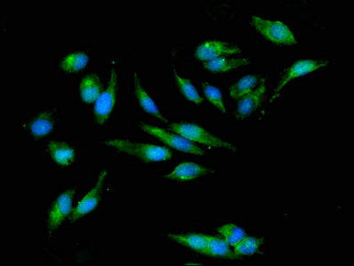 Immunofluorescent analysis of Hela cells using CSB-PA018473LA01HU at dilution of 1:100 and Alexa Fluor 488-congugated AffiniPure Goat Anti-Rabbit IgG(H+L)