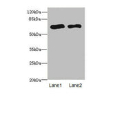 Western blot All lanes: PPM1Dantibody at 2.36ug/ml Lane 1: Rat gonadal tissue Lane 2: U87 whole cell lysate Secondary Goat polyclonal to rabbit IgG at 1/10000 dilution Predicted band size: 67, 48 kDa Observed band size: 67 kDa