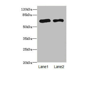 Western blot All lanes: PPM1Dantibody at 2.36ug/ml Lane 1: Rat gonadal tissue Lane 2: U87 whole cell lysate Secondary Goat polyclonal to rabbit IgG at 1/10000 dilution Predicted band size: 67, 48 kDa Observed band size: 67 kDa