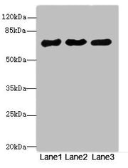 Western blot All lanes: PPM1Dantibody at 2.66ug/ml Lane 1: Rat gonadal tissue Lane 2: U87 whole cell lysate Lane 3: 293T whole cell lysate Secondary Goat polyclonal to rabbit IgG at 1/10000 dilution Predicted band size: 67, 48 kDa Observed band si...