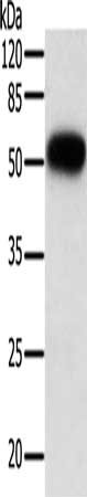 Gel: 10%SDS-PAGE, Lysate: 40 ug, Lane: A549 cells, Primary antibody: CSB-PA018500(TNFRSF10B Antibody) at dilution 1/500, Secondary antibody: Goat anti rabbit IgG at 1/8000 dilution, Exposure time: 10 seconds