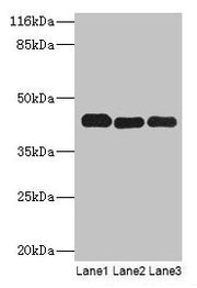 Western blot All lanes: PPME1 antibody at 2µg/ml Lane 1: A549 whole cell lysate Lane 2: Hela whole cell lysate Lane 3: Mouse brain tissue Secondary Goat polyclonal to rabbit IgG at 1/10000 dilution Predicted band size: 43, 23, 19, 44 kDa Observed...