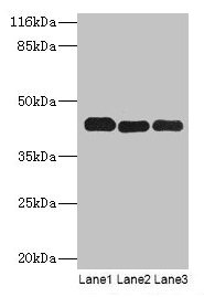 Western blot All lanes: PPME1 antibody at 2µg/ml Lane 1: A549 whole cell lysate Lane 2: Hela whole cell lysate Lane 3: Mouse brain tissue Secondary Goat polyclonal to rabbit IgG at 1/10000 dilution Predicted band size: 43, 23, 19, 44 kDa Observed...