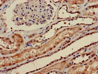 Immunohistochemistry of paraffin-embedded human kidney tissue using CSB-PA018503LA01HU at dilution of 1:100