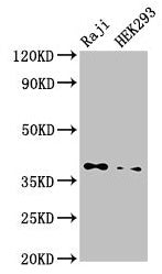 Western Blot Positive WB detected in: Raji whole cell lysate, HEK293 whole cell lysate All lanes: PPP1CB antibody at 3.5µg/ml Secondary Goat polyclonal to rabbit IgG at 1/50000 dilution Predicted band size: 38 kDa Observed band size: 38 kDa