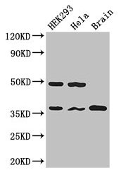 Western Blot Positive WB detected in: HEK293 whole cell lysate, Hela whole cell lysate, Mouse brain tissue All lanes: PPP1CC antibody at 2.7µg/ml Secondary Goat polyclonal to rabbit IgG at 1/50000 dilution Predicted band size: 37, 39 kDa Observed...