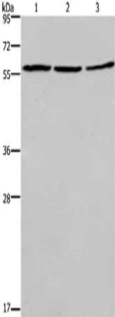 Gel: 8%SDS-PAGE,Lysate: 40 ug,Lane 1-3: Jurkat cells, 231 cells, Hela cells,Primary antibody: CSB-PA018543(CCNB1 Antibody) at dilution 1/300 dilution,Secondary antibody: Goat anti rabbit IgG at 1/8000 dilution,Exposure time: 10 seconds