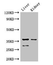 Western Blot Positive WB detected in: Mouse liver tissue, Mouse kidney tissue All lanes: PPP2CA antibody at 2.5ug/ml Secondary Goat polyclonal to rabbit IgG at 1/50000 dilution Predicted band size: 36, 30 kDa Observed band size: 36, 30 kDa