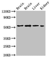 Western Blot Positive WB detected in: Rat brain tissue, Mouse brain tissue, Mouse liver tissue, Mouse kidney tissue All lanes: PPP2R2A antibody at 3ug/ml Secondary Goat polyclonal to rabbit IgG at 1/50000 dilution Predicted band size: 52, 53 kDa O...