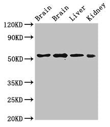 Western Blot Positive WB detected in: Rat brain tissue, Mouse brain tissue, Mouse liver tissue, Mouse kidney tissue All lanes: PPP2R2A antibody at 3ug/ml Secondary Goat polyclonal to rabbit IgG at 1/50000 dilution Predicted band size: 52, 53 kDa O...