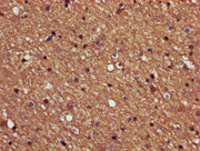 IHC image of CSB-PA018565LA01HU diluted at 1:600 and staining in paraffin-embedded human brain tissue performed on a Leica BondTM system. After dewaxing and hydration, antigen retrieval was mediated by high pressure in a citrate buffer (pH 6.0). S...