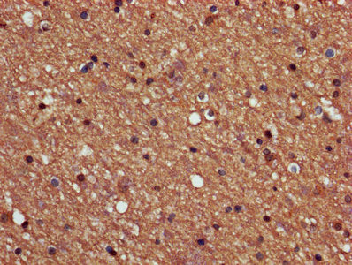 IHC image of CSB-PA018565LA01HU diluted at 1:600 and staining in paraffin-embedded human brain tissue performed on a Leica BondTM system. After dewaxing and hydration, antigen retrieval was mediated by high pressure in a citrate buffer (pH 6.0). S...