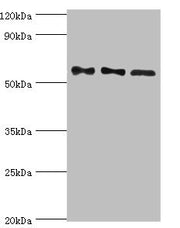 Western blot All lanes: Serine/threonine-protein phosphatase 2B catalytic subunit gamma isoform antibody at 10ug/ml Lane 1: Rat brain tissue Lane 2: MCF-7 whole cell lysate Lane 3: Rat skeletal muscle tissue Secondary Goat polyclonal to rabbit IgG...