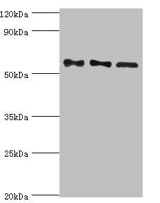 Western blot All lanes: Serine/threonine-protein phosphatase 2B catalytic subunit gamma isoform antibody at 10ug/ml Lane 1: Rat brain tissue Lane 2: MCF-7 whole cell lysate Lane 3: Rat skeletal muscle tissue Secondary Goat polyclonal to rabbit IgG...