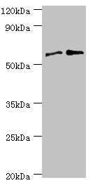 Western blot All lanes: Serine/threonine-protein phosphatase 2B catalytic subunit gamma isoform antibody at 8ug/ml Lane 1: Rat brain tissue Lane 2: MCF-7 whole cell lysate Secondary Goat polyclonal to rabbit IgG at 1/10000 dilution Predicted band...