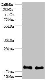 Western blot All lanes: PPP3R1 antibody at 1µg/ml Lane 1: K562 whole cell lysate Lane 2: Hela whole cell lysate Secondary Goat polyclonal to rabbit IgG at 1/10000 dilution Predicted band size: 20 kDa Observed band size: 20 kDa