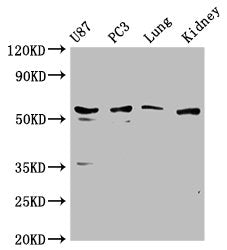 Western Blot Positive WB detected in: U87 whole cell lysate, PC3 whole cell lysate, Mouse lung tissue, Mouse kidney tissue All lanes: PPP5C antibody at 1:1000 Secondary Goat polyclonal to rabbit IgG at 1/50000 dilution Predicted band size: 57 kDa...