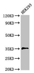 Western Blot Positive WB detected in: HEK293 whole cell lysate All lanes: PPT1 antibody at 3.5µg/ml Secondary Goat polyclonal to rabbit IgG at 1/50000 dilution Predicted band size: 35, 24 kDa Observed band size: 35 kDa