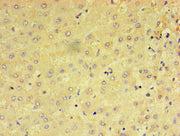 Immunohistochemistry of paraffin-embedded human liver tissue using CSB-PA018603LA01HU at dilution of 1:100
