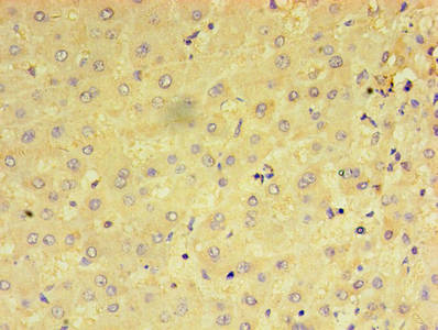 Immunohistochemistry of paraffin-embedded human liver tissue using CSB-PA018603LA01HU at dilution of 1:100
