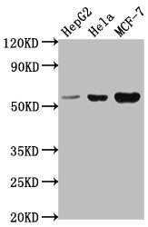 Western Blot Positive WB detected in: HepG2 whole cell lysate, Hela whole cell lysate, MCF-7 whole cell lysate All lanes: PRAMEF18 antibody at 1:2000 Secondary Goat polyclonal to rabbit IgG at 1/50000 dilution Predicted band size: 56 kDa Observed...