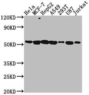 Western Blot Positive WB detected in: Hela whole cell lysate, MCF-7 whole cell lysate, HepG2 whole cell lysate, A549 whole cell lysate, 293T whole cell lysate, U87 whole cell lysate, Jurkat whole cell lysate All lanes: PRAMEF6 antibody at 1:2000 S...