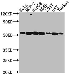 Western Blot Positive WB detected in: Hela whole cell lysate, MCF-7 whole cell lysate, HepG2 whole cell lysate, A549 whole cell lysate, 293T whole cell lysate, U87 whole cell lysate, Jurkat whole cell lysate All lanes: PRAMEF6 antibody at 1:2000 S...