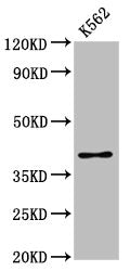 Western Blot Positive WB detected in: K562 whole cell lysate All lanes: PRB1 antibody at 3.16µg/ml Secondary Goat polyclonal to rabbit IgG at 1/50000 dilution Predicted band size: 39 kDa Observed band size: 39 kDa