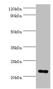 Western blot All lanes: Peroxiredoxin-1 antibody at 2ug/ml + Hela whole cell lysate Secondary Goat polyclonal to rabbit IgG at 1/10000 dilution Predicted band size: 22 kDa Observed band size: 22 kDa