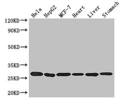 Western Blot Positive WB detected in: Hela whole cell lysate, HepG2 whole cell lysate, MCF-7 whole cell lysate, Mouse heart tissue, Mouse liver tissue, Mouse stomach tissue All lanes: PRDX3 antibody at 3.2µg/ml Secondary Goat polyclonal to rabbit...
