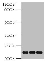 Western blot All lanes: PRDX5 antibody at 4µg/ml Lane 1: Mouse brain tissue Lane 2: Hela whole cell lysate Lane 3: 293T whole cell lysate Secondary Goat polyclonal to rabbit IgG at 1/10000 dilution Predicted band size: 23, 18, 13 kDa Observed band...