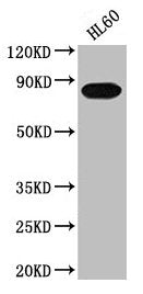 Western Blot Positive WB detected in: HL60 whole cell lysate All lanes: PREP antibody at 1:2000 Secondary Goat polyclonal to rabbit IgG at 1/50000 dilution Predicted band size: 81 kDa Observed band size: 81 kDa