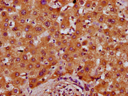 IHC image of CSB-PA018665LA01HU diluted at 1:400 and staining in paraffin-embedded human liver tissue performed on a Leica BondTM system. After dewaxing and hydration, antigen retrieval was mediated by high pressure in a citrate buffer (pH 6.0). S...