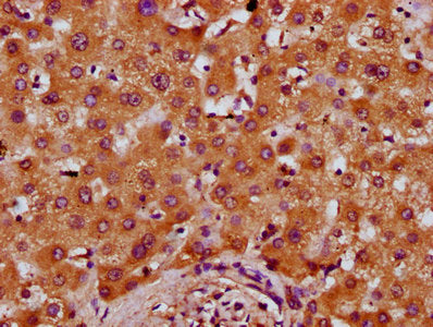 IHC image of CSB-PA018665LA01HU diluted at 1:400 and staining in paraffin-embedded human liver tissue performed on a Leica BondTM system. After dewaxing and hydration, antigen retrieval was mediated by high pressure in a citrate buffer (pH 6.0). S...