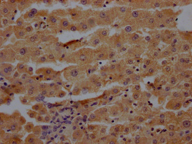 IHC image of CSB-PA018672LA01HU diluted at 1:200 and staining in paraffin-embedded human liver tissue performed on a Leica BondTM system. After dewaxing and hydration, antigen retrieval was mediated by high pressure in a citrate buffer (pH 6.0). S...