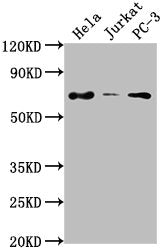 Western Blot Positive WB detected in: Hela whole cell lysate, Jurkat whole cell lysate, PC-3 whole cell lysate All lanes: PRICKLE3 antibody at 1:2000 Secondary Goat polyclonal to rabbit IgG at 1/50000 dilution Predicted band size: 69, 60 kDa Obser...