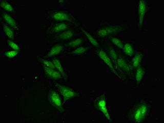 Immunofluorescent analysis of Hela cells using CSB-PA018680LA01HU at dilution of 1:100 and Alexa Fluor 488-congugated AffiniPure Goat Anti-Rabbit IgG(H+L)