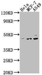 Western Blot Positive WB detected in: Hela whole cell lysate, MCF-7 whole cell lysate, A549 whole cell lysate All lanes: PRKACA antibody at 1:2000 Secondary Goat polyclonal to rabbit IgG at 1/50000 dilution Predicted band size: 41, 40 kDa Observed...