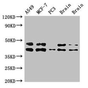 Western Blot Positive WB detected in: A549 whole cell lysate, MCF-7 whole cell lysate, PC-3 whole cell lysate, Rat brain tissue, Mouse brain tissue All lanes: PRKACB antibody at 3ug/ml Secondary Goat polyclonal to rabbit IgG at 1/50000 dilution Pr...